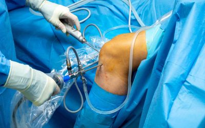 Artroskopie kolenního kloubu